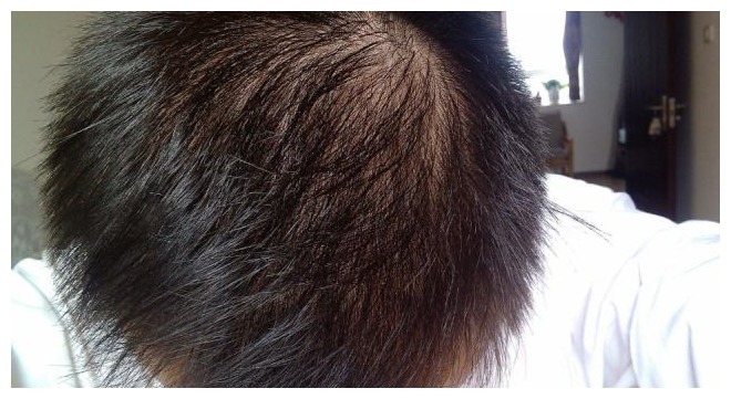 夫妻生活|男性开始衰老的3个丑态，如果一个都没有，就偷着笑吧