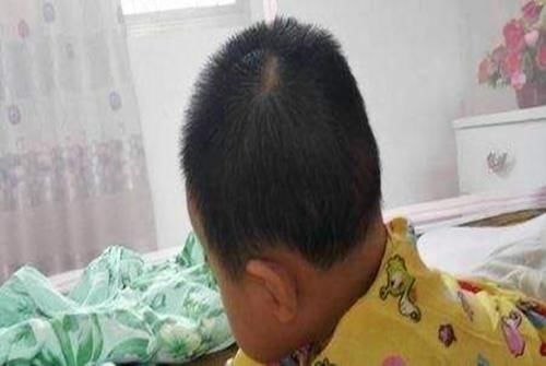 堪比|“睡扁头”的畸形美，堪比古代的“裹脚”，能放过孩子的头吗？