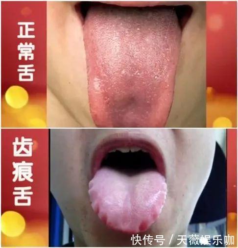 健脾养胃|脾胃差,鸡内金与它们搭配,经常喝一点,健脾养胃,清除脏腑垃圾