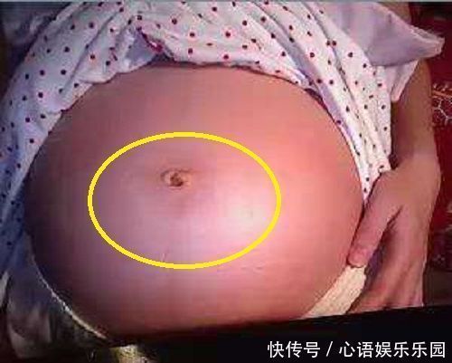 压迫|女性怀孕后,肚脐眼是凸起是凹进,受3个因素影响,别轻易忽视