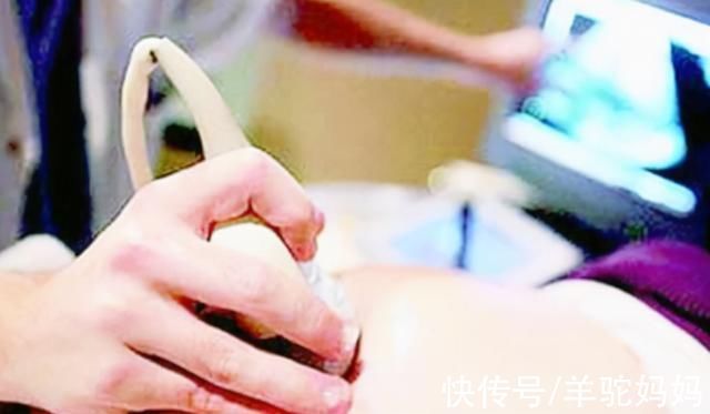 胎心|孕期若宝妈出现这3种表现,恭喜你,多半是怀了“男宝宝”