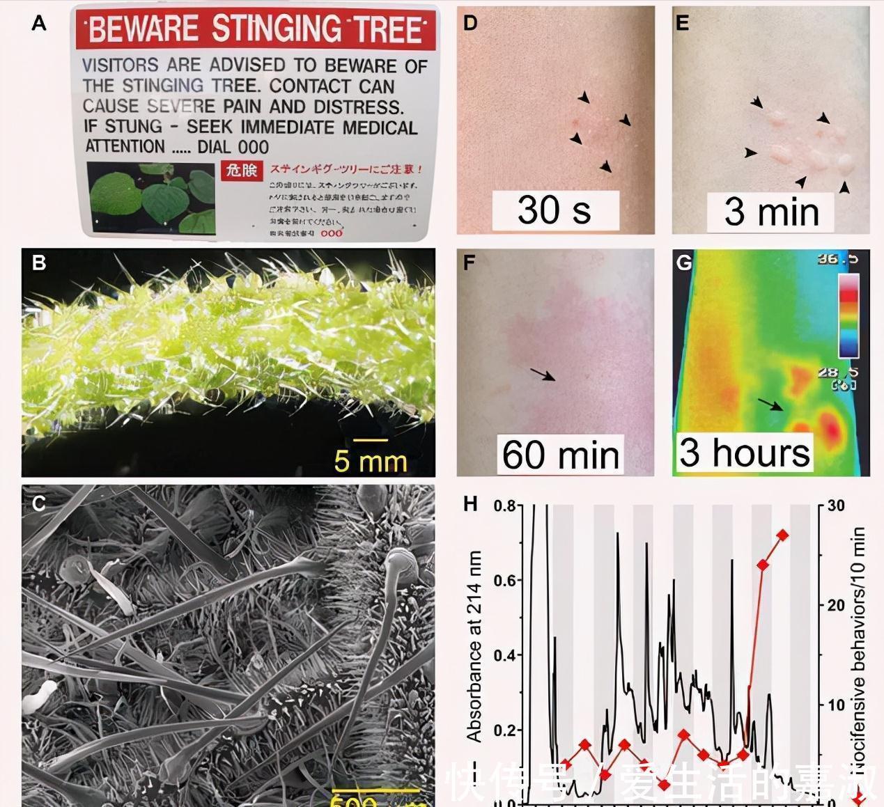金皮树|认识植物界的“六大毒树”,看到“绕道走”,涨知识不吃亏