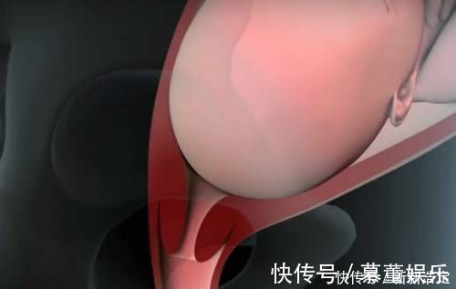 胎儿|产道那么小婴儿是怎么出来的这张图很生动,看完感叹母爱伟大