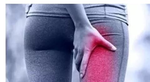 臀部|梨状肌综合征：导致臀部疼痛的罪魁祸首！