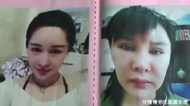 抽脂手术|女子花费三十万整容,不曾想变得更丑了,网友:不整容挺好看的啊