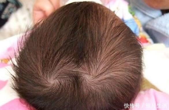 智商|孩子头顶有“2个旋”代表什么?和性格、智商有关吗?家长要清楚