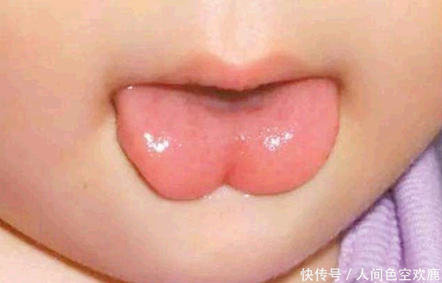 医生|1岁宝宝还不会说话,奶奶出生时没剪“舌根”,被医生揭穿