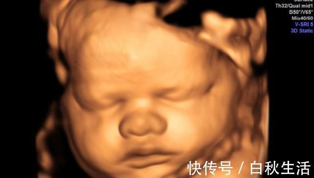医生|孕妈做排畸检查,医生说太胖看不到孩子的脸,孕妈该咋做呢