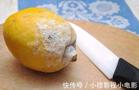 检查|身体2处“发痒”,别以为只是过敏,或是肝脏异常,尽早去检查