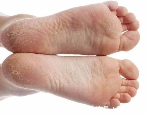 肝脏|提醒:肝不好的人,尽量别碰这两种蔬菜,可能会伤肝,别不当回事