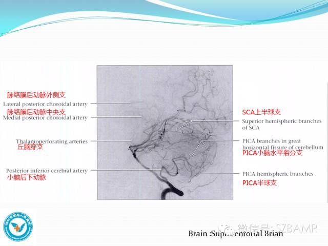 mr|椎-基底动脉系统解剖