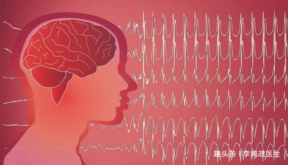安眠药中毒|女性头晕2天以为感冒,第3天突然猝死,医生本可治疗,错过时间