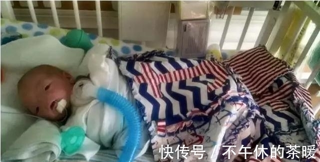 一生|小男孩天生无鼻,却坚持走完了一生