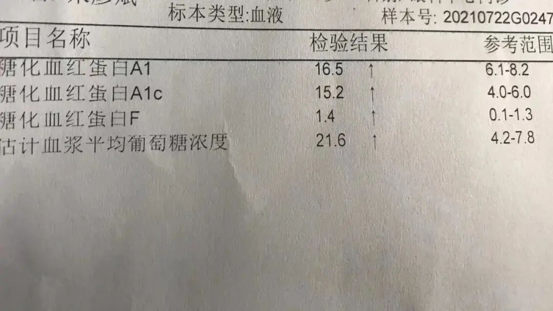 男孩|15岁男孩眼球突然变白！夏季一定多注意