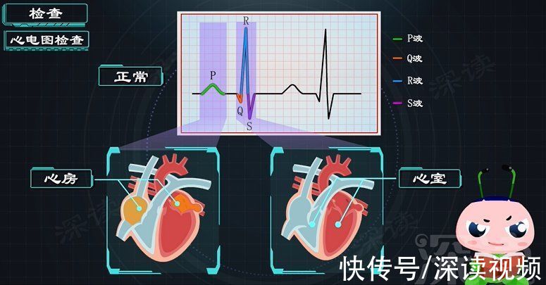 心房|久坐房颤发生率高5倍？酗酒肥胖更易得房颤？房颤发病因素知多少