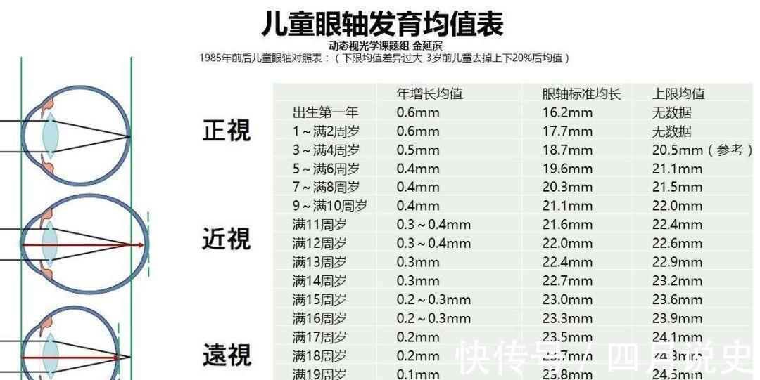 近视|科普|眼轴长度评估在近视防控中的重要作用!