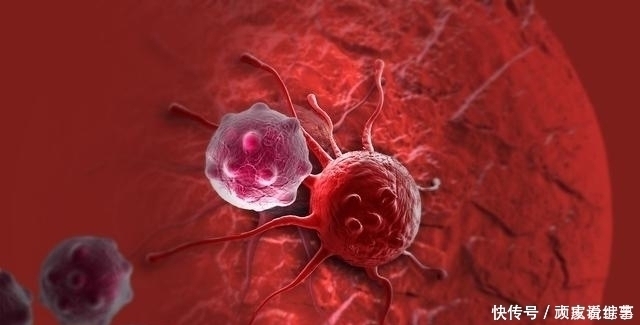癌症|肿瘤患者福音,只要脏器功能还在,就可以很好地活下去