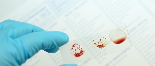 A型ab型小孩什么血型 A型ab型小孩什么血型