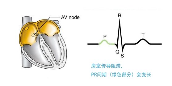 窦性心动过缓|官方认定「心动过缓」的标准,心跳慢到什么程度要看医生?