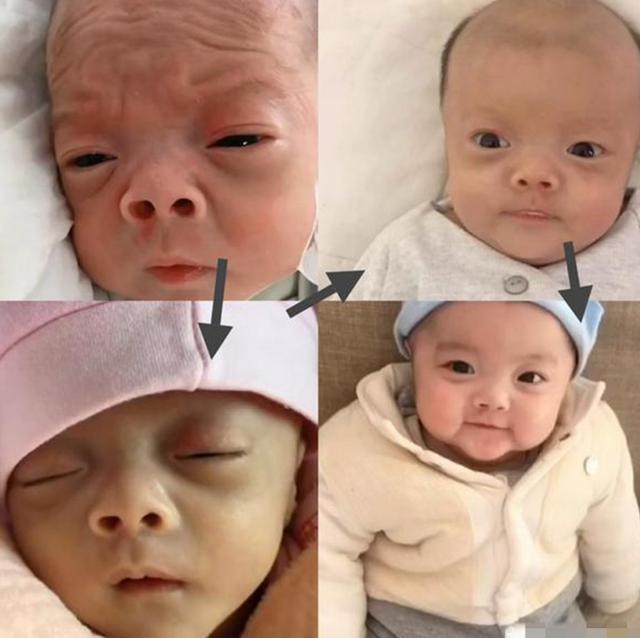 妈妈|“外星人宝宝”火了,刚出生丑哭宝妈,2个月后颜值成功逆袭
