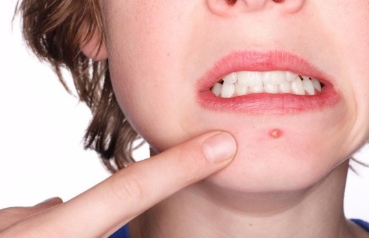 红霉素|红霉素睡前抹一抹,醒来皮肤“重回十八”,尤其女性要了解