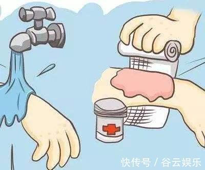纱布|4岁儿子被开水烫伤,妈妈的“两个果断”救了娃,医生称赞做得对