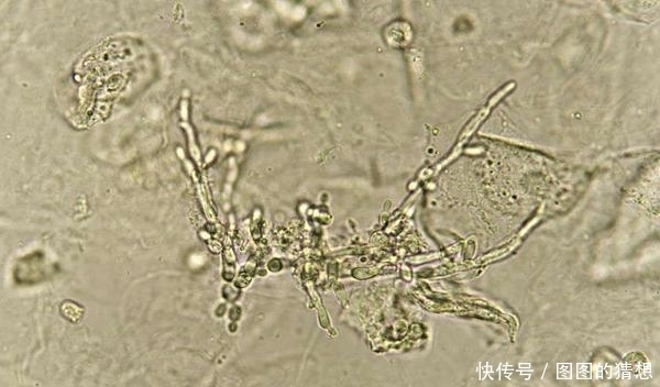 家里几处地方,是黄曲霉素的“温床”,为健康着想,尽快处理