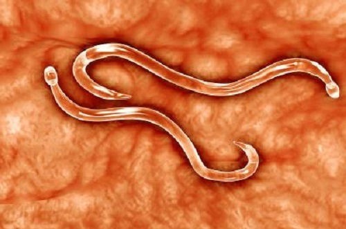 感染|2岁女儿患上“蛲虫病”,得知原因后,宝妈直接气得带孩子回娘家