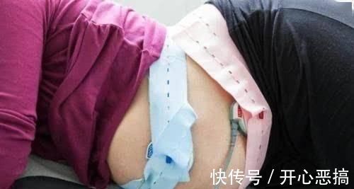 胎位|生孩子时，都会遇到哪些突发情况这6大状况，孕妈不妨先了解下