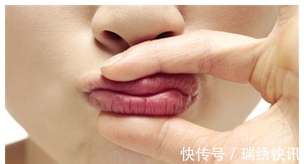 女人|女人有没有妇科病，看嘴巴或许就知道，对照自测，希望你一个没有