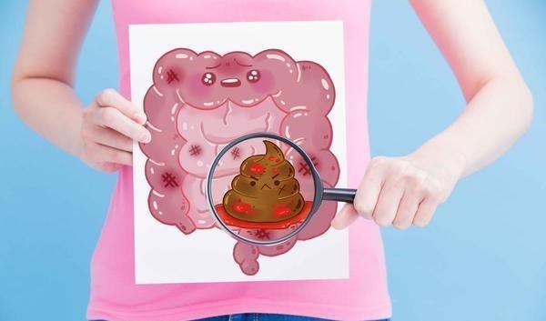 腫瘤|結腸癌查出多是晚期？醫生叮囑：這4種癥狀，別再視若無睹了！