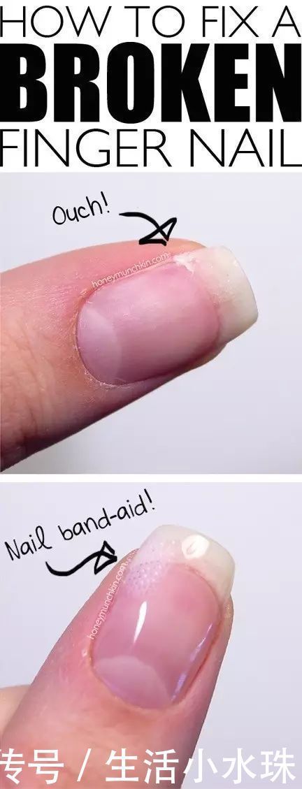 创可贴的神奇用途,还有这么多人不知道