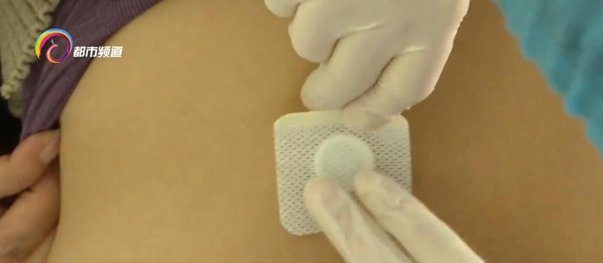 冬至一过，三九贴敷正当时