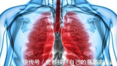 肺癌|早期肺癌一定没有症状吗?未必!一些蛛丝马迹要小心