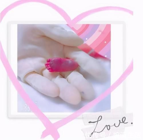 奶粉|那个出生才4百克的“巴掌公主”，半年过去怎样了？生命真是神奇