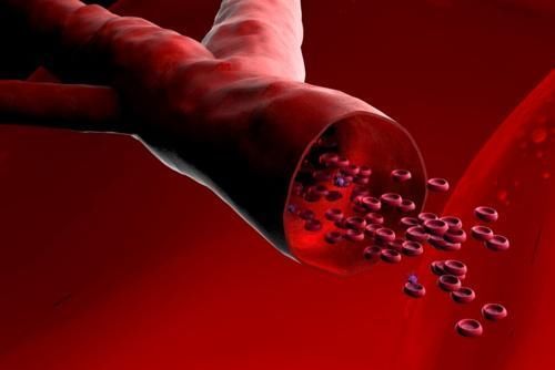 血压偏高|高血压的人不能多喝水?血压偏高的人,这些食物尽量远离