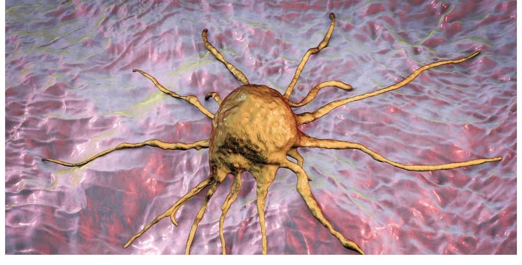 二甲基|为什么现在癌症越来越多?医生提示:50岁后,这3种饮食尽量少碰