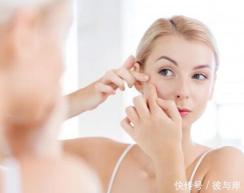 3个预防痘印的方法!及时做好,不用为痘印问题困扰