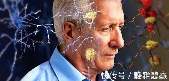 医生|为何老年痴呆越来越多医生这3种食物是“祸患”,尽早远离