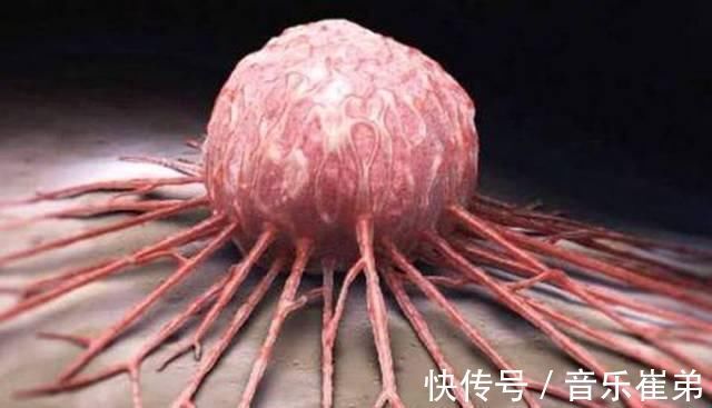 食物|得了癌症别害怕每天吃这几种食物,癌细胞可能会“悄悄溜走”