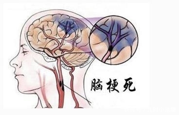 紫菜|血管最怕堵,让你花2块钱不到,只需一碗汤,给血管“洗个澡”!