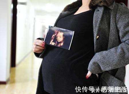 彩超|四维彩超能够预防胎儿畸形吗?四维彩超真正有6个作用,别搞错