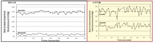 房颤患者|房颤合并高血压,这样降压更有效!