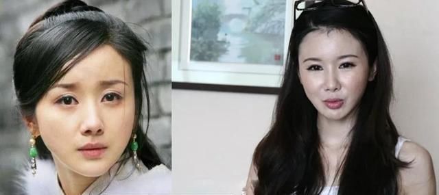 张檬后悔整容卖惨上热搜蹭热度，比张檬美十倍的她，也被整容害了