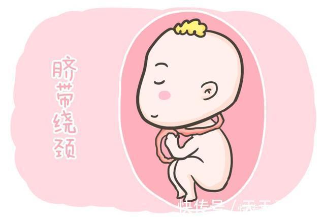 谣言|胎宝“脐带绕颈”,并不是准妈妈常摸肚子造成的,别再勿信谣言了