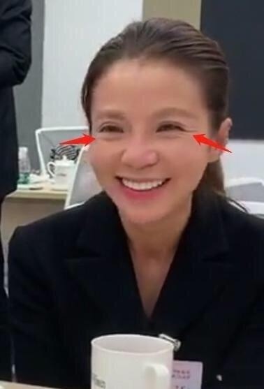 朱迅|没开美颜直播的朱迅,满脸皱纹皮肤松弛的特真实,是老阿姨!