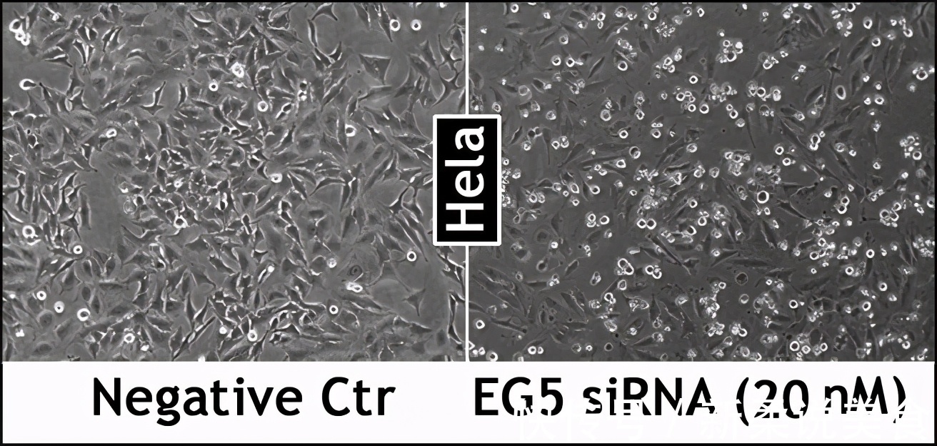 细胞|注射一针疫苗，就能杀死身上所有癌细胞，这种理想离实现有多远