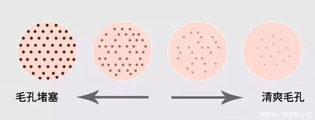 皮脂|黑头反反复复那是因为你用错了方法