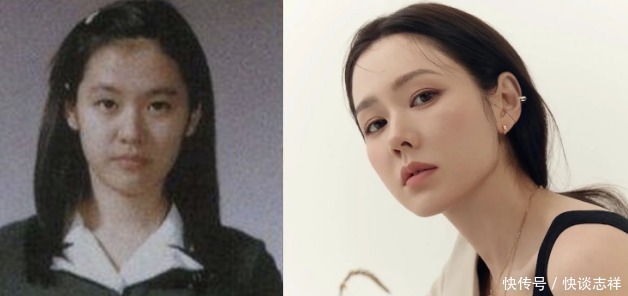 鼻尖抬高,鼻翼惊现疤痕,号称天然美女代名词的她,也翻车了?