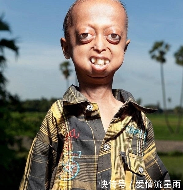 夫妇|【奇闻】印度夫妇生下6个“外星人”,求助医生,医生大骂:无知